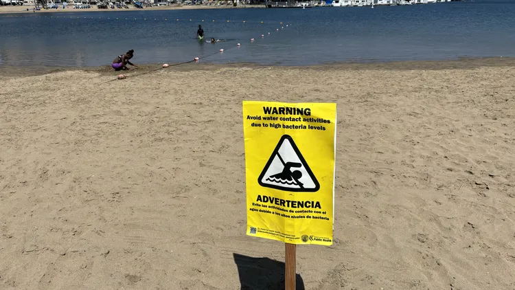 You might know that Los Angeles beaches get dirty after a winter storm, but it remains a problem in the summer, too. Why? And does it keep anyone away?